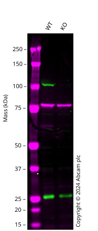 Western blot - Human PRKD2 knockout A549 cell line (AB301181)