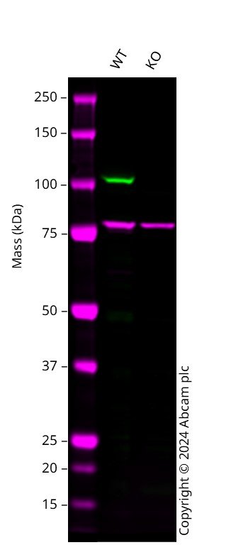 Human PRKD2 knockout A549 cell line