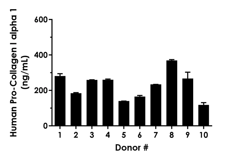 Sandwich ELISA - Human Pro-Collagen I alpha 1 ELISA Kit, Chemiluminescent (AB325360)