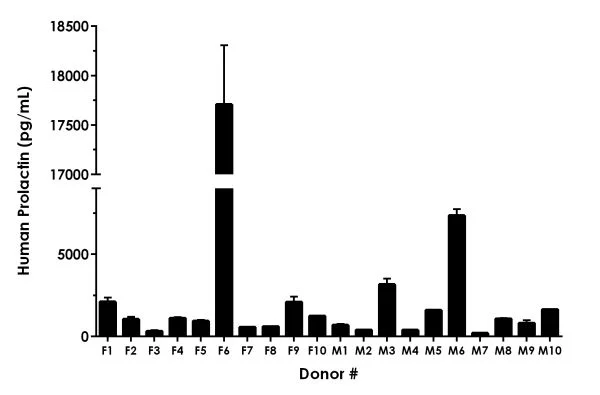 Sandwich ELISA - Human Prolactin/PRL ELISA Kit (AB226901)