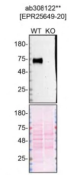 Western blot - Human PSAP knockout HeLa cell line (AB265989)