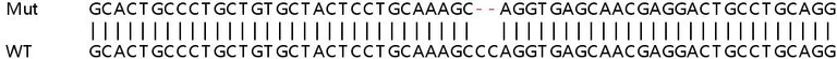 Sanger Sequencing - Human PSCA knockout HeLa cell lysate (AB258608)