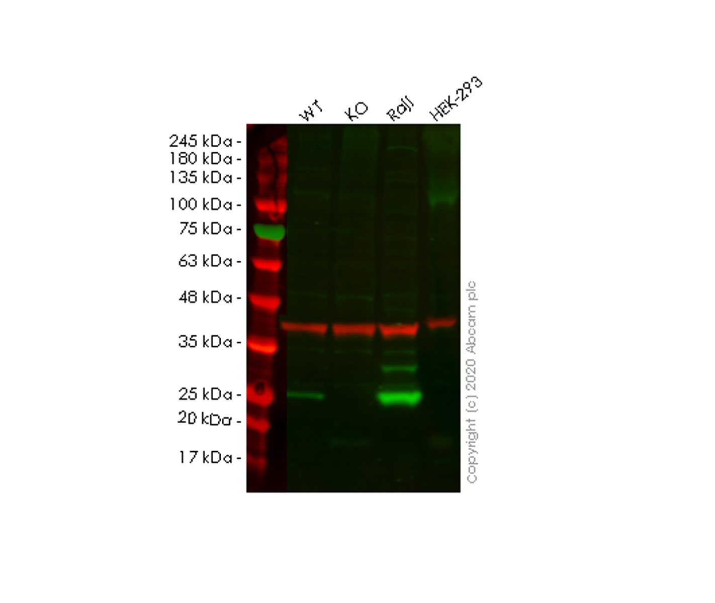 Human PSMB8 (Proteasome 20S LMP7) knockout A549 cell line
