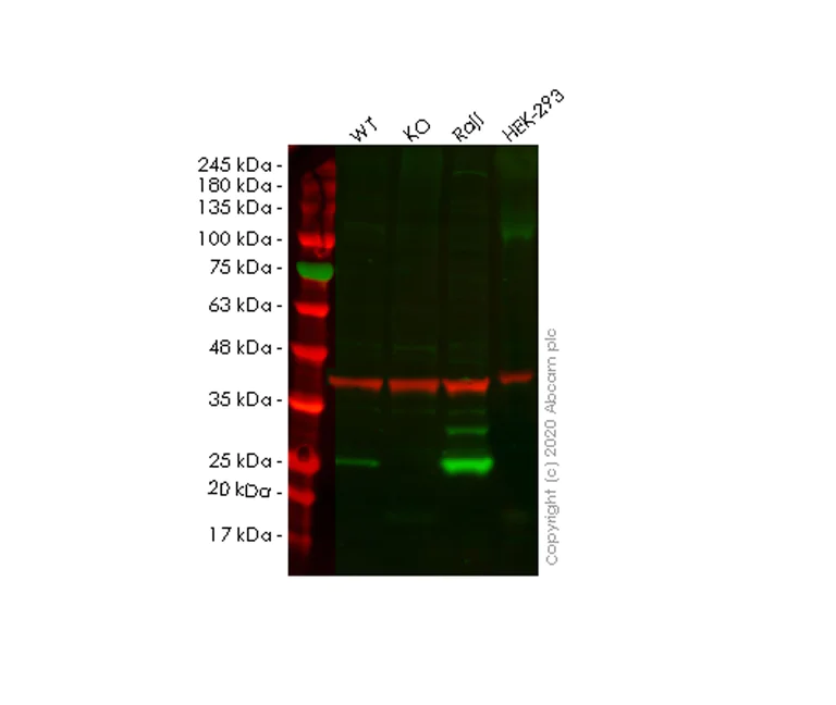 Western blot - Human PSMB8 (Proteasome 20S LMP7) knockout A549 cell line (AB267148)