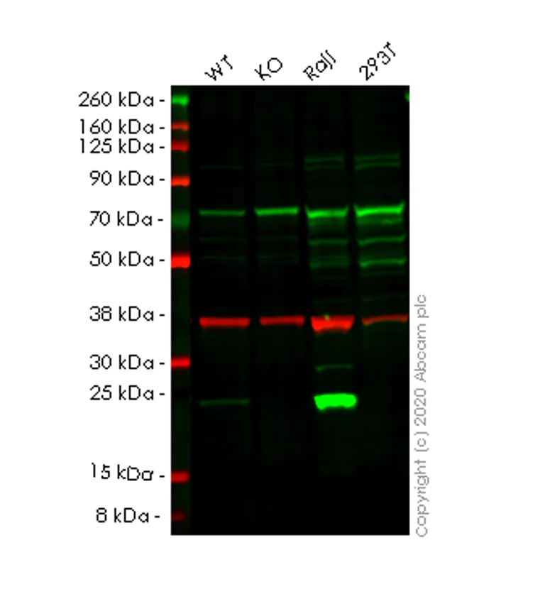 Western blot - Human PSMB8 (Proteasome 20S LMP7) knockout A549 cell lysate (AB257130)