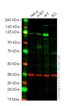 Western blot - Human PTK2 (FAK) knockout HEK-293T cell line (AB255421)