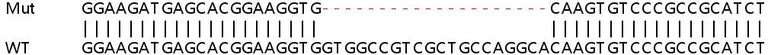 Sanger Sequencing - Human PTS (PTPS) knockout HeLa cell lysate (AB263322)
