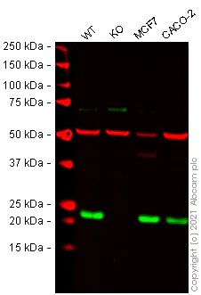 Western blot - Human RAB29 knockout A549 cell line (AB280040)