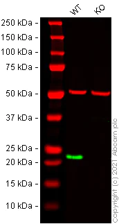 Western blot - Human RAB7A (RAB7) knockout HeLa cell lysate (AB263831)