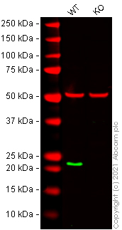Western blot - Human RAB7A (RAB7) knockout HeLa cell lysate (AB263831), expandable thumbnail