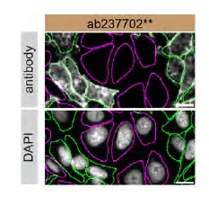 Immunocytochemistry/ Immunofluorescence - Human RAB8A knockout HeLa cell line (AB264993)