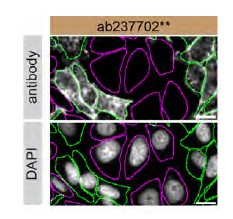 Immunocytochemistry/ Immunofluorescence - Human RAB8A knockout HeLa cell lysate (ab257195), expandable thumbnail