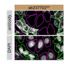 Immunocytochemistry/ Immunofluorescence - Human RAB8A knockout HeLa cell lysate (AB257195)