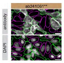 Immunocytochemistry/ Immunofluorescence - Human RAB8A knockout HeLa cell lysate (ab257195), expandable thumbnail