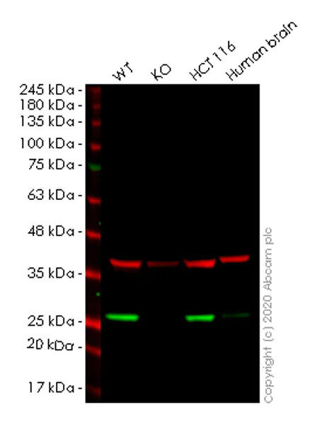 Western blot - Human RAB8A knockout HeLa cell lysate (AB257195)