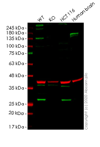 Western blot - Human RAB8A knockout HeLa cell lysate (AB257195)
