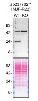 Western blot - Human RAB8A knockout HeLa cell lysate (AB257195), expandable thumbnail