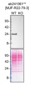 Western blot - Human RAB8A knockout HeLa cell lysate (AB257195), expandable thumbnail