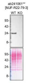 Western blot - Human RAB8A knockout HeLa cell lysate (AB257195)