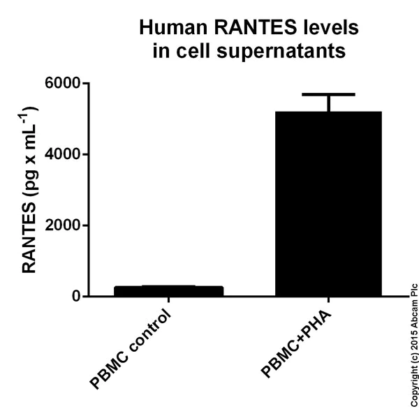 Sandwich ELISA - Human RANTES ELISA Kit (AB100633)