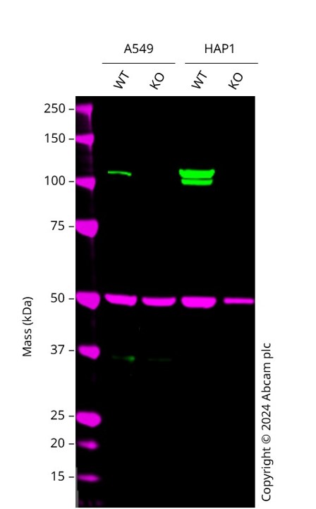 Western blot - Human RB1 knockout A549 cell line (AB286470), expandable thumbnail