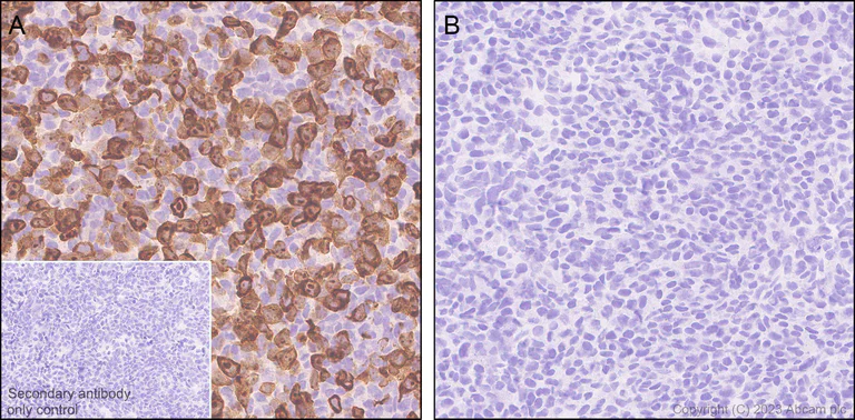 Immunohistochemistry (Formalin/PFA-fixed paraffin-embedded sections) - Anti-Human respiratory syncytial virus A Nucleoprotein antibody [EPR28656-26] (AB316207)