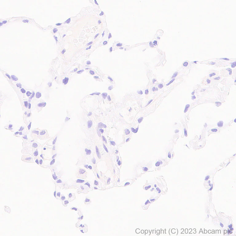 Immunohistochemistry (Formalin/PFA-fixed paraffin-embedded sections) - Anti-Human respiratory syncytial virus A Nucleoprotein antibody [EPR28656-26] (AB316207)
