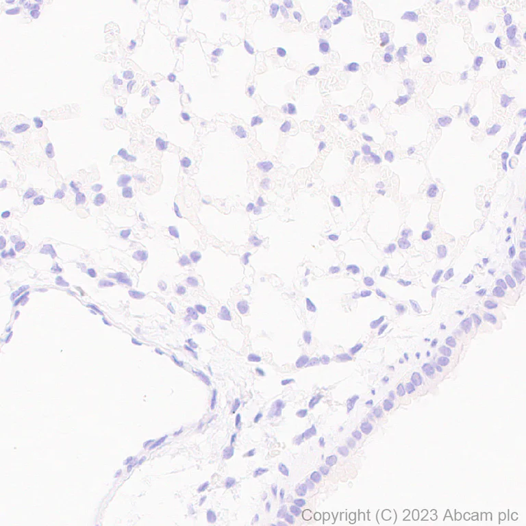 Immunohistochemistry (Formalin/PFA-fixed paraffin-embedded sections) - Anti-Human respiratory syncytial virus A Nucleoprotein antibody [EPR28656-26] - BSA and Azide free (AB316208)