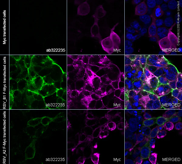 Immunocytochemistry/ Immunofluorescence - Anti-Human respiratory syncytial virus Fusion (F) Glycoprotein antibody [4.15] (AB322235)