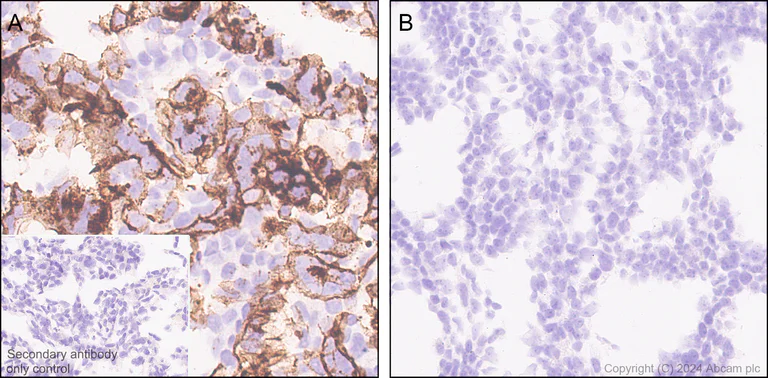 Immunohistochemistry (Formalin/PFA-fixed paraffin-embedded sections) - Anti-Human respiratory syncytial virus Fusion (F) Glycoprotein antibody [4.15] - BSA and Azide free (AB324763)