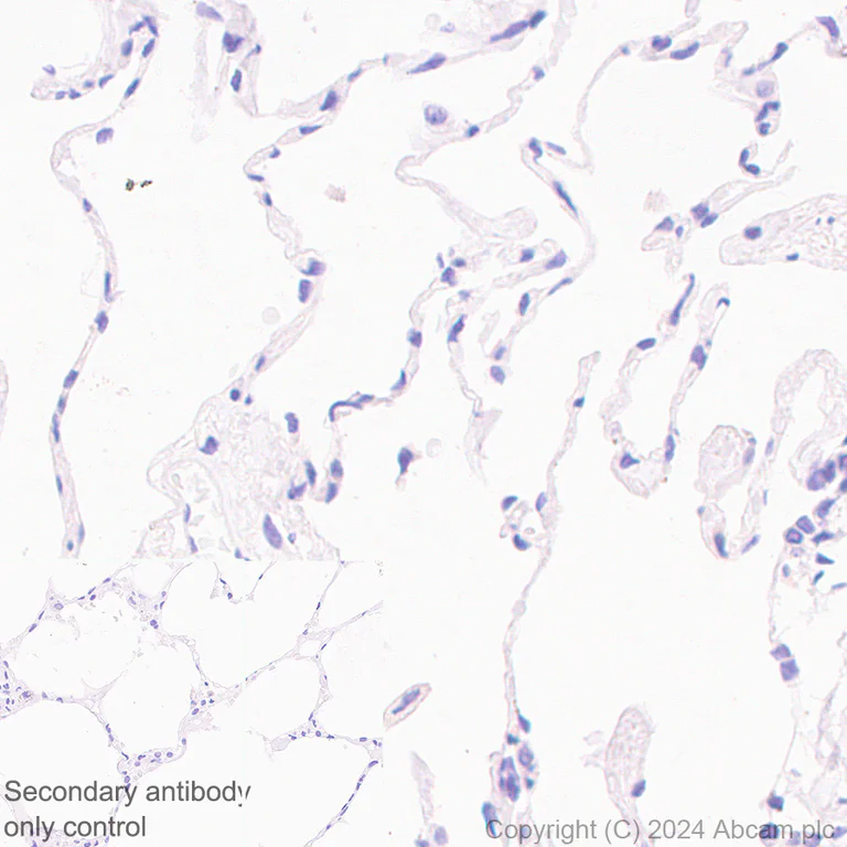 Immunohistochemistry (Formalin/PFA-fixed paraffin-embedded sections) - Anti-Human respiratory syncytial virus Fusion (F) Glycoprotein antibody [4.15] - BSA and Azide free (AB324763)