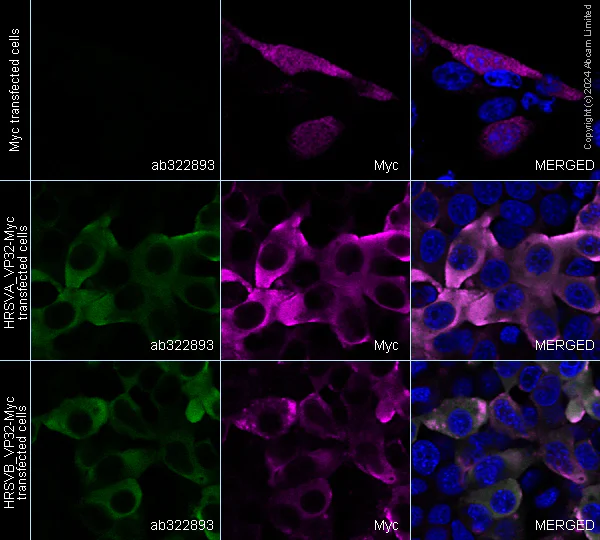 Immunocytochemistry/ Immunofluorescence - Anti-Human respiratory syncytial virus phosphoprotein VP32 antibody [3.5-18] (AB322893)