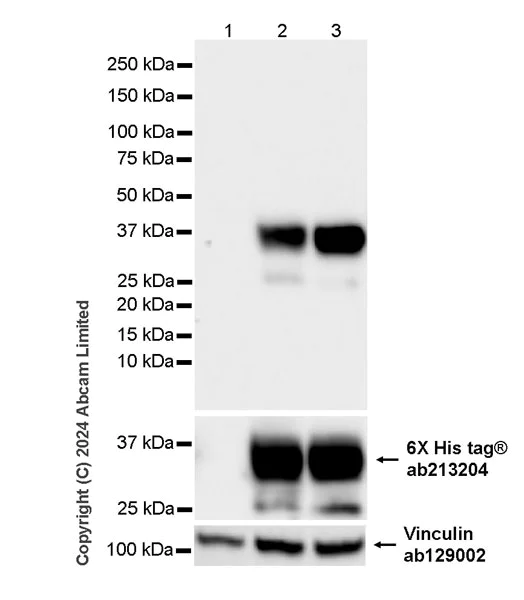 Western blot - Anti-Human respiratory syncytial virus phosphoprotein VP32 antibody [3.5-18] - BSA and Azide free (AB324815)