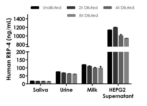 Sandwich ELISA - Human Retinol Binding Protein 4 ELISA Kit (AB196264)
