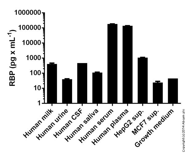 Human Retinol binding protein ELISA Kit (RBP)