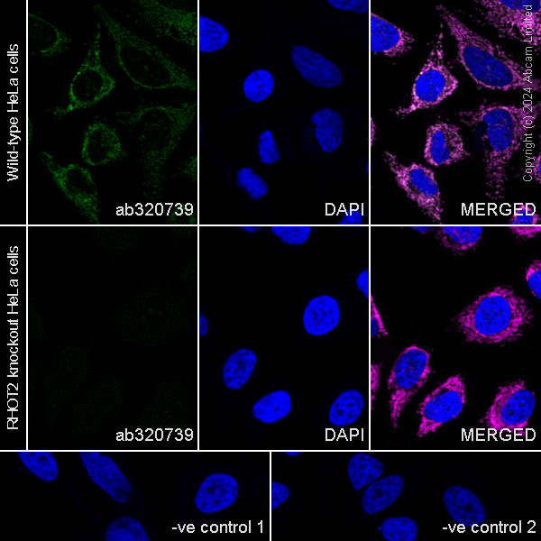 Immunocytochemistry/ Immunofluorescence - Human RHOT2 (MIRO2) knockout HeLa cell line (AB265801), expandable thumbnail