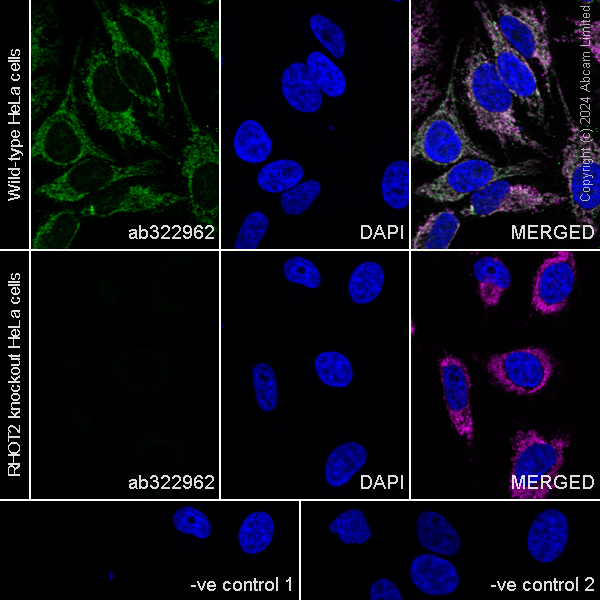 Immunocytochemistry/ Immunofluorescence - Human RHOT2 (MIRO2) knockout HeLa cell line (AB265801), expandable thumbnail