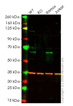 Western blot - Human RIPK2 (RIP2) knockout HeLa cell lysate (AB258636)