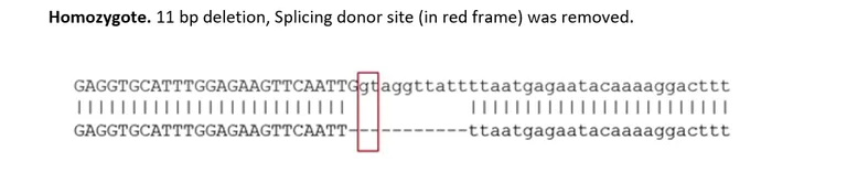 Sanger Sequencing - Human ROCK1 knockout HeLa cell line (AB308493)