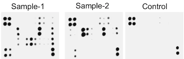 Multiplex Protein Detection - Human RTK Phosphorylation Antibody Array -Membrane (71 Targets) (AB193662)