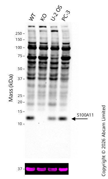 Western blot - Human S100A11 knockout HeLa cell line (AB265085)