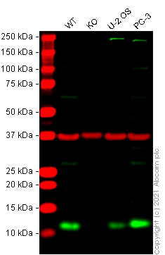 Human S100A11 knockout HeLa cell lysate