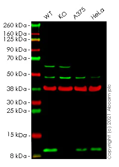 Western blot - Human S100A4 knockout A549 cell line (AB261865)