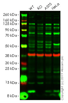 Western blot - Human S100A4 knockout A549 cell line (AB261865), expandable thumbnail
