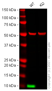 Western blot - Human S100A4 knockout HeLa cell lysate (AB257046), expandable thumbnail