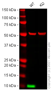 Western blot - Human S100A4 knockout HeLa cell lysate (AB257046)