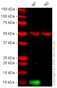 Western blot - Human S100A4 knockout HeLa cell lysate (AB257046), expandable thumbnail