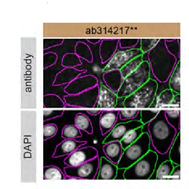 Immunocytochemistry/ Immunofluorescence - Human SCARB2 knockout MCF7 cell line (AB274952)