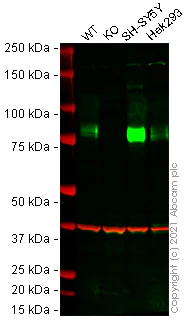 Western blot - Human SCARB2 knockout MCF7 cell line (AB274952)