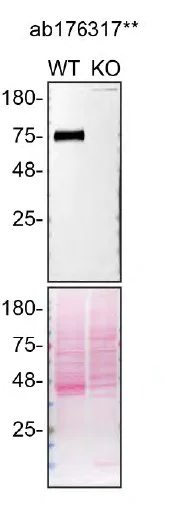 Western blot - Human SCARB2 knockout MCF7 cell line (AB274952)